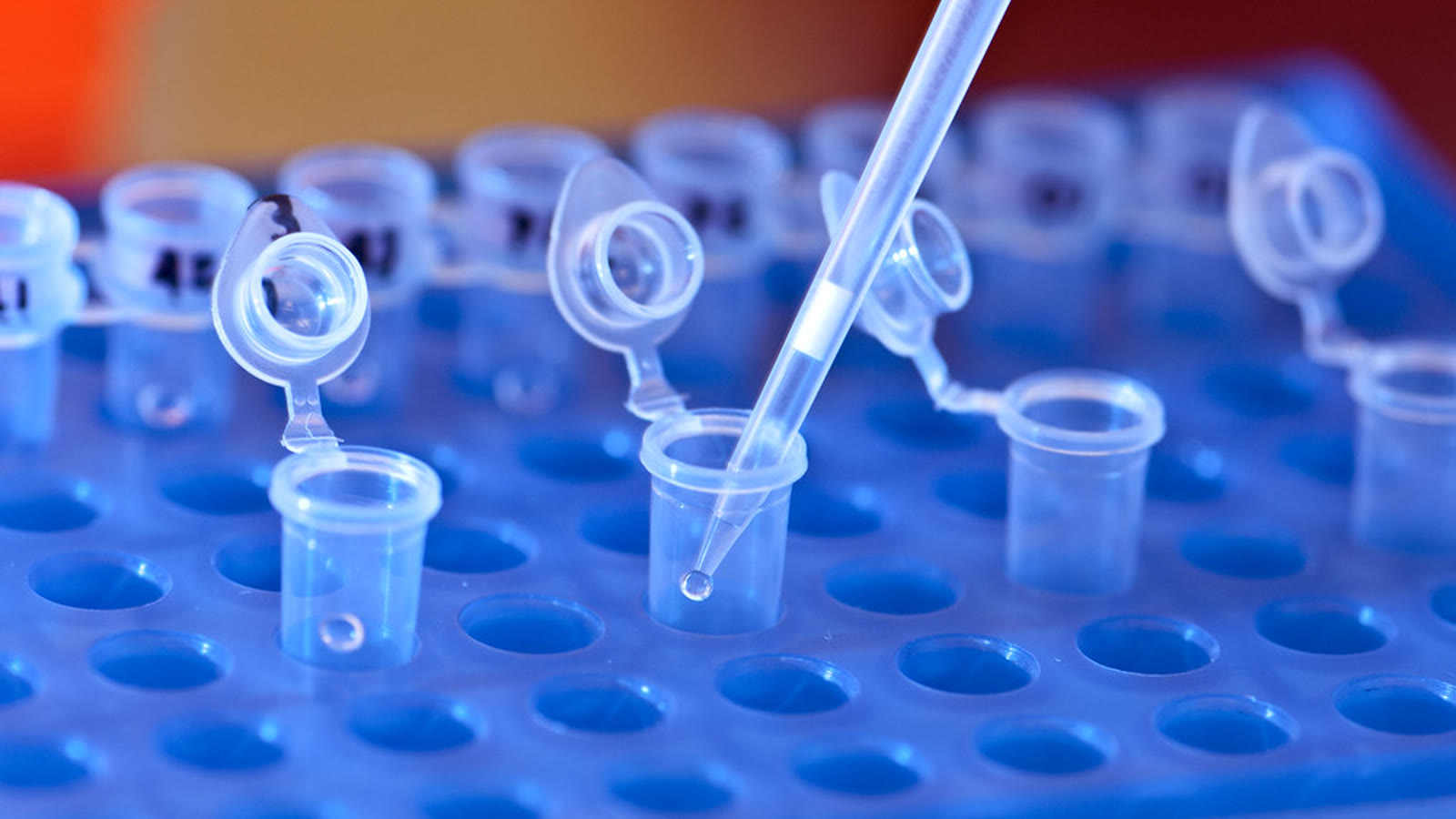 Material de laboratorio para un TFG de Biotecnología